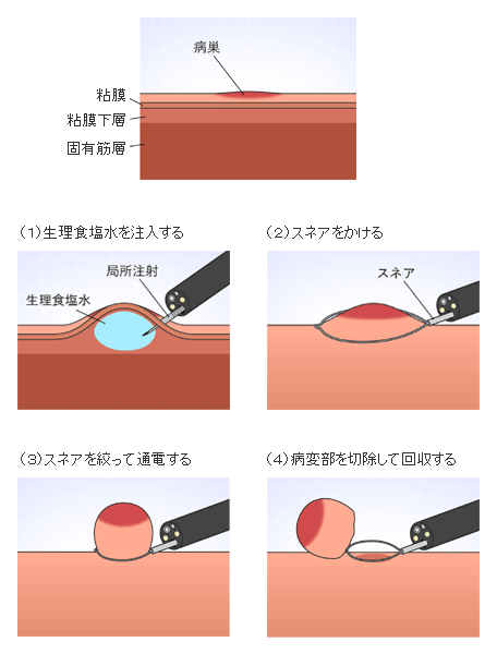 内視鏡内科